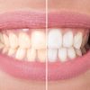 NHpro Zahnschmelz Care & Sensitiv – Bild 4