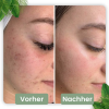 cleansecrets GreenStick Tiefenreinigungsmaske 1 Greenstick (24,95€/Stick) – Bild 8