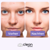 cleansecrets EggplantStick Vital Maske (Up) – Bild 4