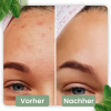 cleansecrets GreenStick Tiefenreinigungsmaske 1 Greenstick (24,95€/Stick) – Bild 3
