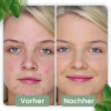 cleansecrets GreenStick Tiefenreinigungsmaske 1 Greenstick (24,95€/Stick) – Bild 6