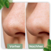 cleansecrets GreenStick Tiefenreinigungsmaske 1 Greenstick (24,95€/Stick) – Bild 5