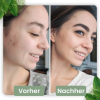 cleansecrets GreenStick Tiefenreinigungsmaske 1 Greenstick (24,95€/Stick) – Bild 4